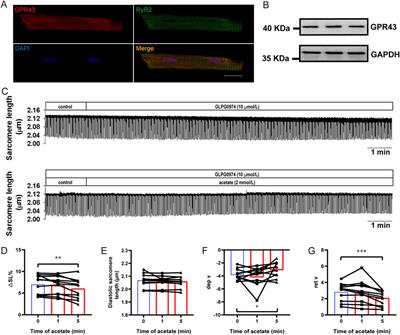 Acetate suppresses myocardial contraction via the short-chain fatty acid receptor GPR43